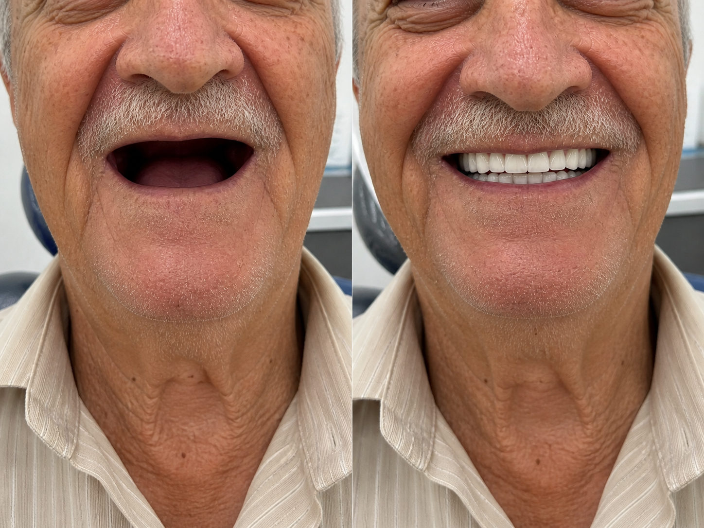 Antes e depois — paciente LP Odonto Prime