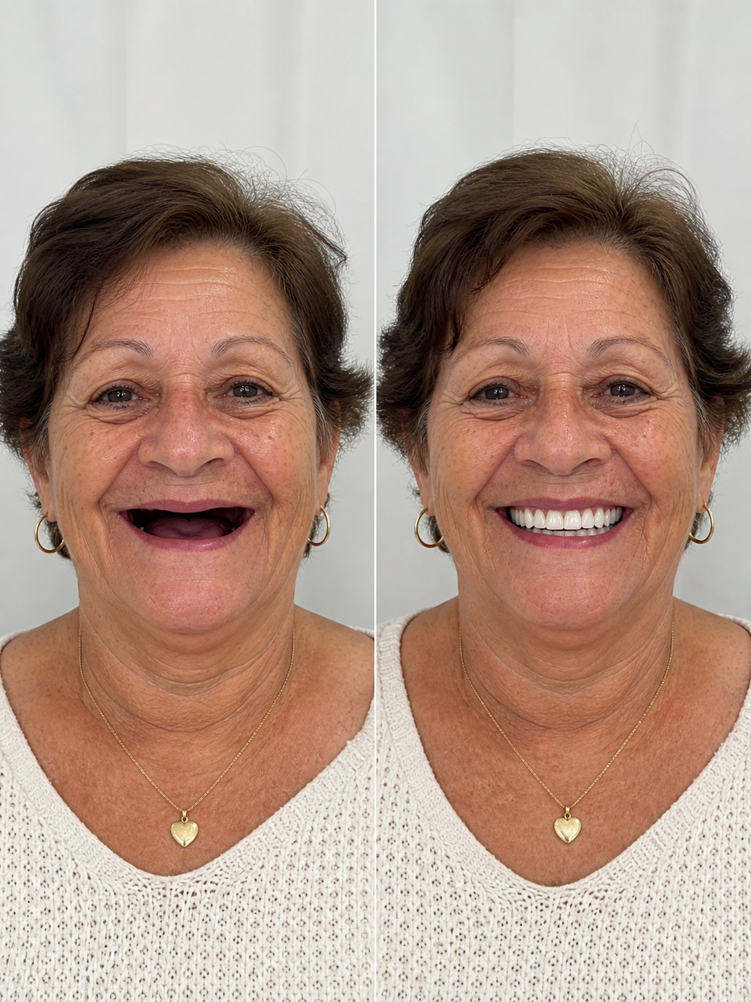 Antes e depois — paciente LP Odonto Prime