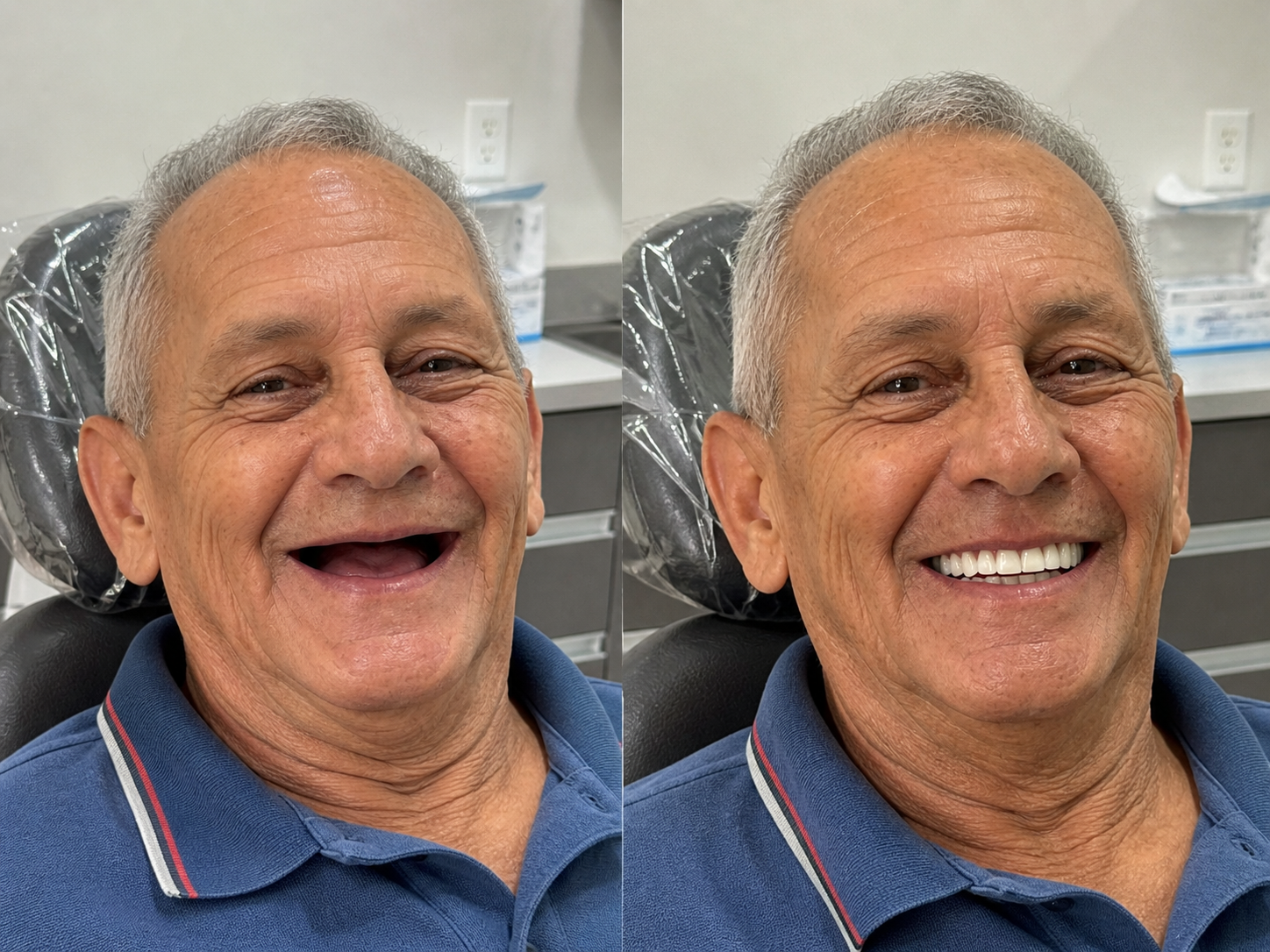 Antes e depois — paciente LP Odonto Prime